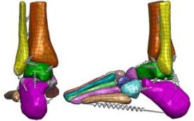 angle model